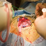 brain surgery brain surgery